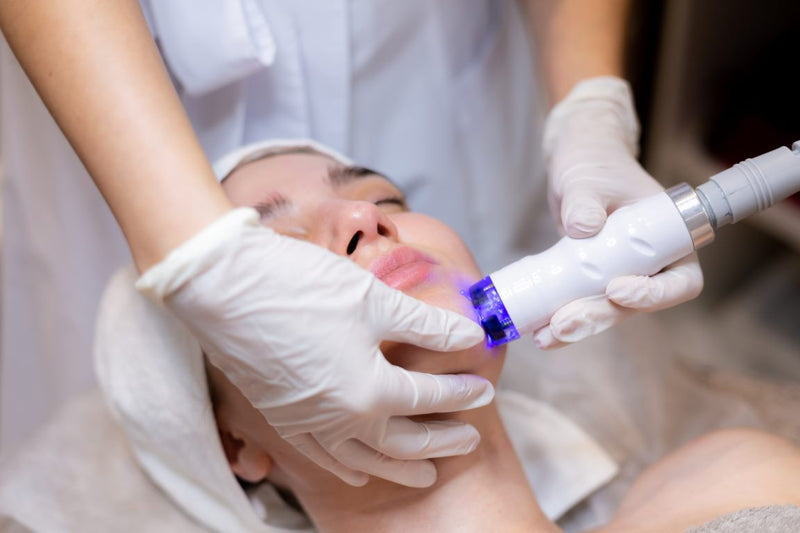 A Guide to Laser Treatment Options For Rosacea