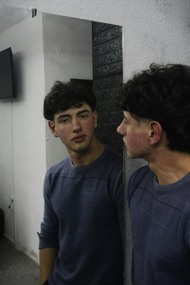 Do men with rosacea sub type 2 often have bad acne when teenagers